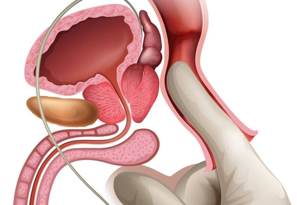 Massage de la prostate