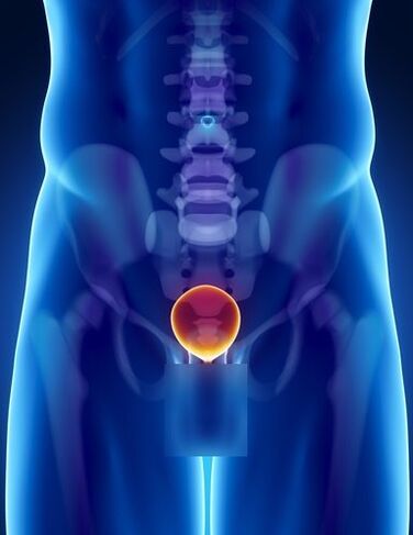 Inflammation de la prostate chez un homme atteint de prostatite