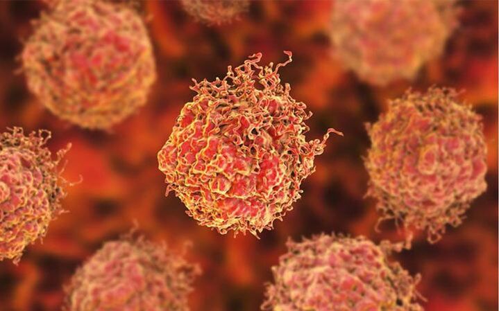 Cellules cancéreuses de la prostate